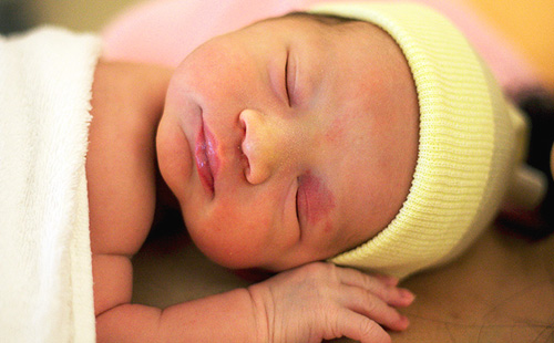 Новорожденный в желтой шапочке