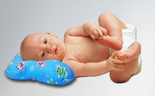 Малыш с кривошеей лежит на синей ортопедической подушке