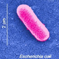 Здоровенная розовая бактерия под микроскопом