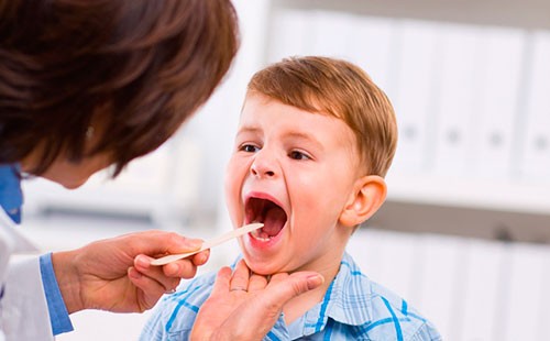 Мальчик показывает горло доктору