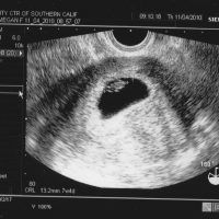 Семинедельный эмбрион на черно-белом снимке